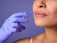 Smoother, Plumper Lips With Dermal Fillers: All Your Questions Answered