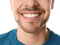 A Guide on How to Fix an Overbite